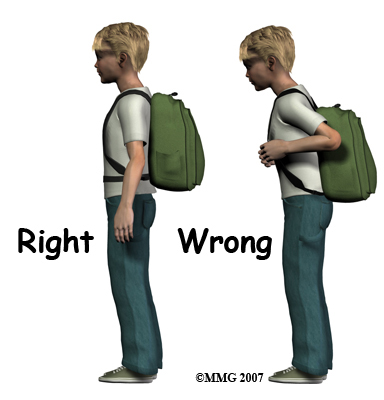 child_back_pain_backpack